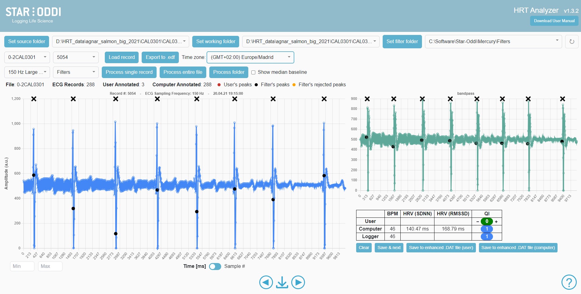 ECG analysis and heart rate validation with our free HRT Analyzer software