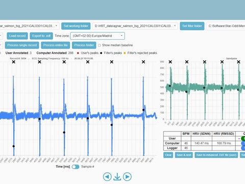 ECG analysis and heart rate validation with our free HRT Analyzer software